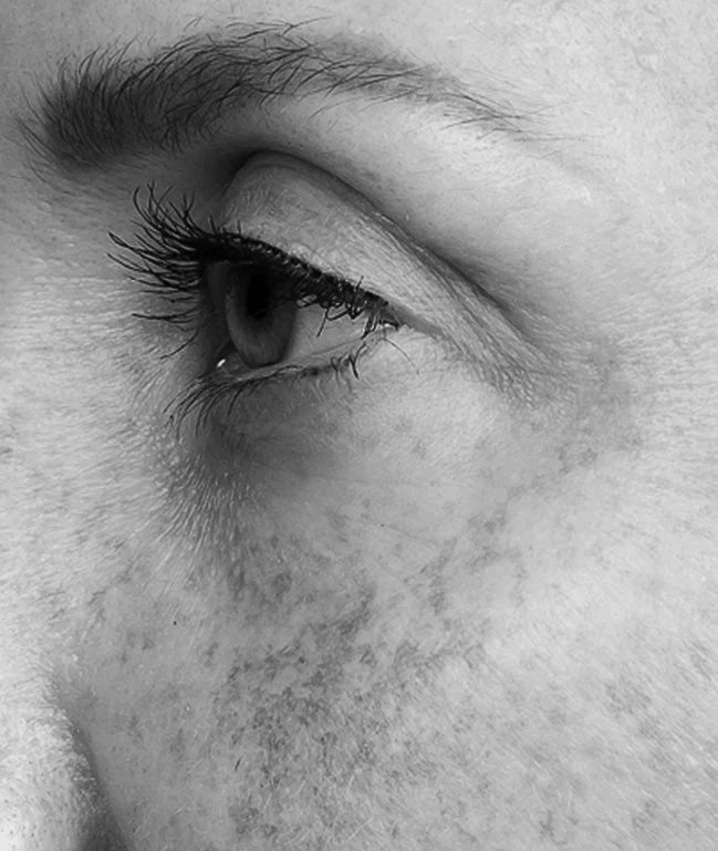 HYPERPIGMENTATION - QMS Medicosmetics - USA and North America