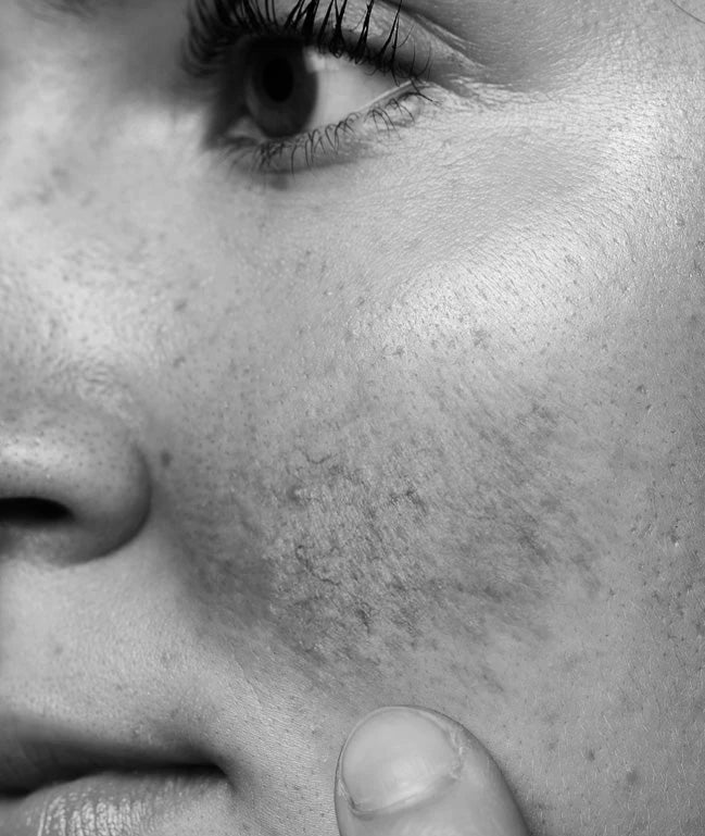 SENSITIVE SKIN - QMS Medicosmetics - USA and North America